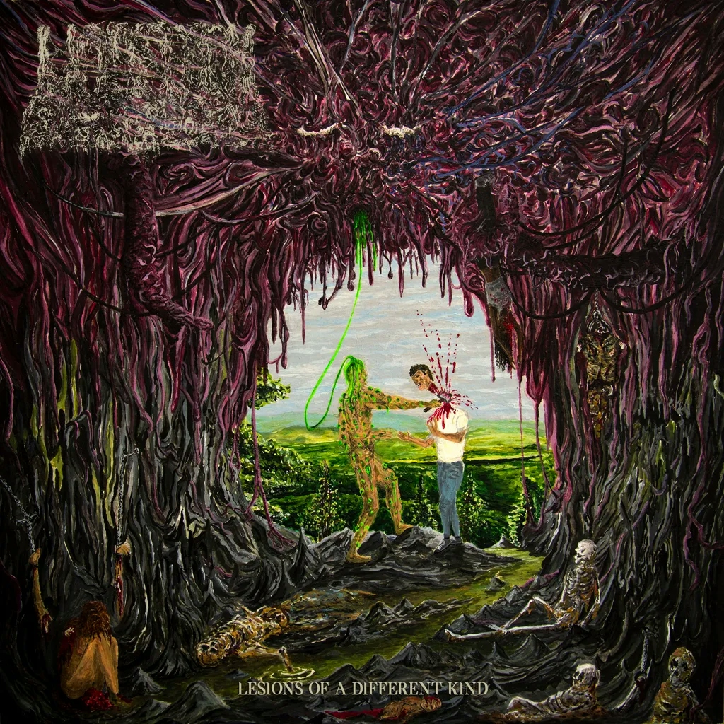 Album artwork for Lesions of a Different Kind by Undeath